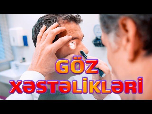 GÖZ XƏSTƏLİKLƏRİ / GÖZ DİBİ XƏSTƏLİKLƏR / oftalmoloq Cahid Şahbazov