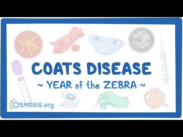 Coats disease (Year of the Zebra 2024)