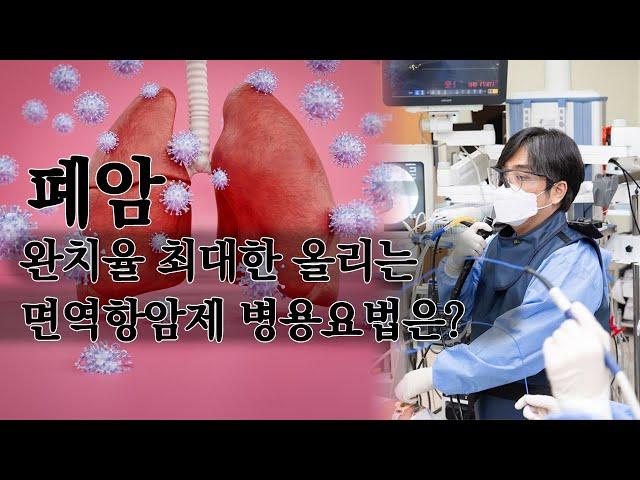 폐암 완치율 최대한 올리는 면역항암제 병용요법은?
