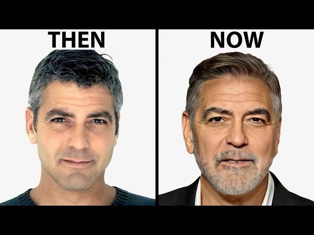 George Clooney's NEW FACE | Plastic Surgery Analysis