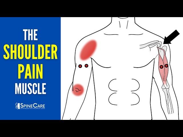 The Shoulder Pain Muscle (How to Release It for INSTANT RELIEF)