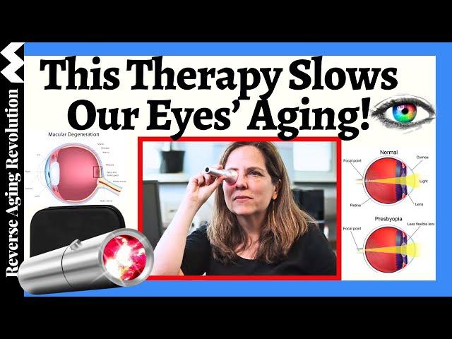 STUNNING Research Shows THIS Therapy Slow The Pace Of Our Eyes' Aging!!!