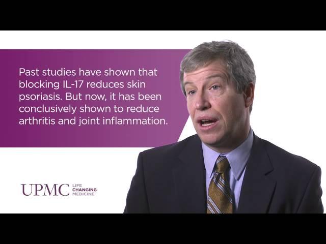 New Therapies for Effectively Treating Psoriatic Arthritis | UPMC