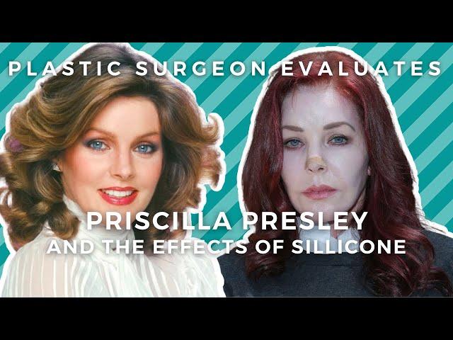 Priscilla Presley Plastic Surgery: Illegal Silicone + Fake Doctors = Botched