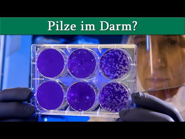 Pilze im Darm? Candida und Schimmelpilze, Teil 1 | Dr. med. Dirk Wiechert