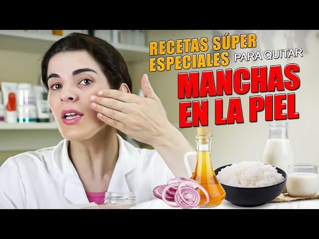 Elimina las MANCHAS DE LA PIEL, incluso el MELASMA - Receta casera