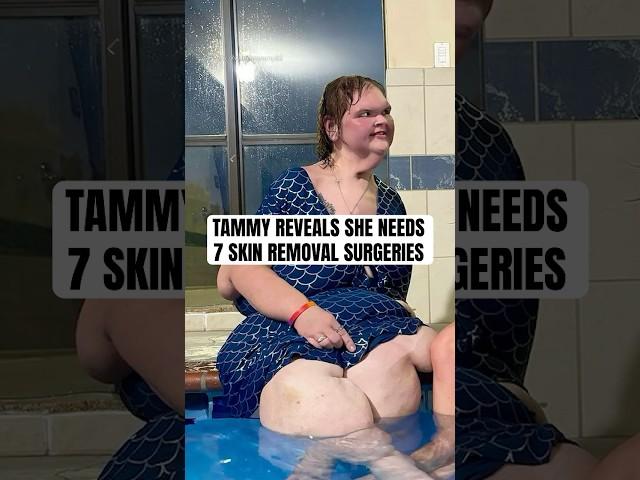 Tammy Slaton Reveals Plans for Skin Removal Surgery After 500lb Weight Loss  #shorts #1000lbsisters