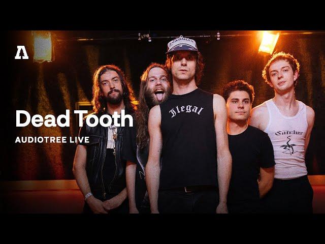 Dead Tooth on Audiotree Live (Full Session)