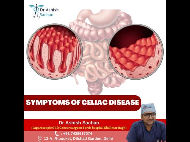 Symptoms of Celiac disease @DrAshishSachan