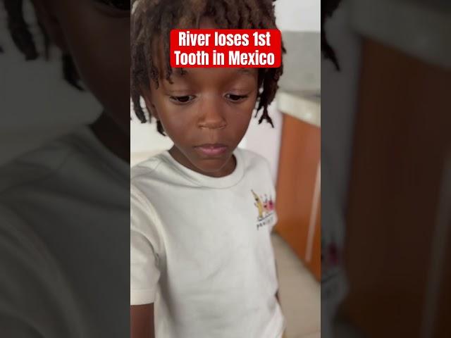 Losing Teeth in Mexico|Living in Merida Mexico