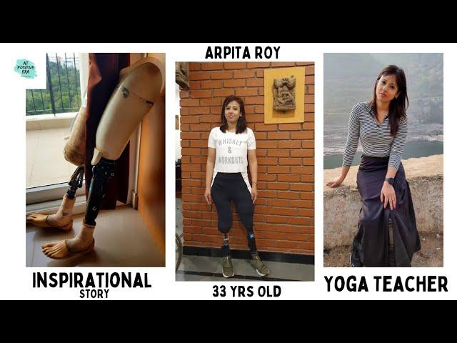 Meet Arpita Roy the Amputee Yoga Instructor who is giving hope to others || WEST BENGAL