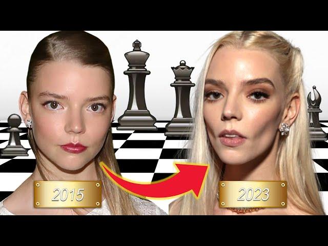 The Extensive Plastic Surgeries of Anya Taylor Joy; So Much So Young