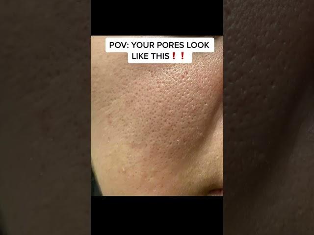 Do you PORES LOOK THIS LARGE?!!!! #skincareroutine #skincare