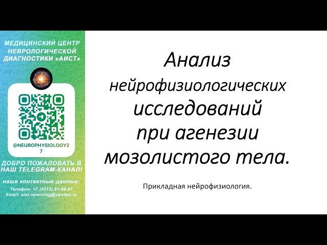 Тема: Анализ нейрофизиологических исследований при агенезии мозолистого тела.