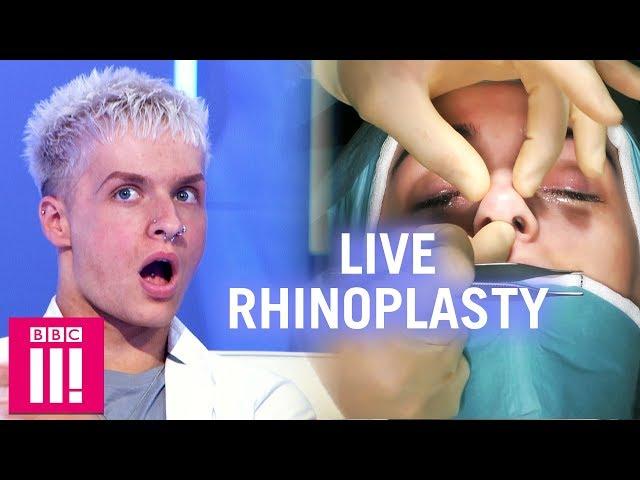 Would You Have A Nose Job After Watching This? | Plastic Surgery Undressed