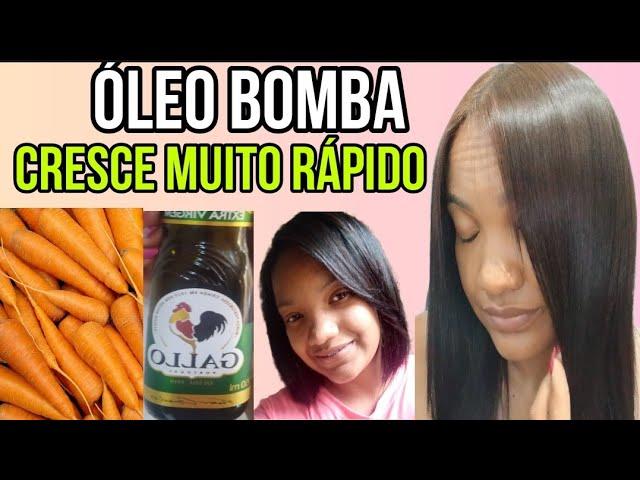 O CABELO CRESCE EM 15 DIAS COM APENAS 3 INGREDIENTES! COMBATE A QUEDA E A QUEBRA CAPILAR!