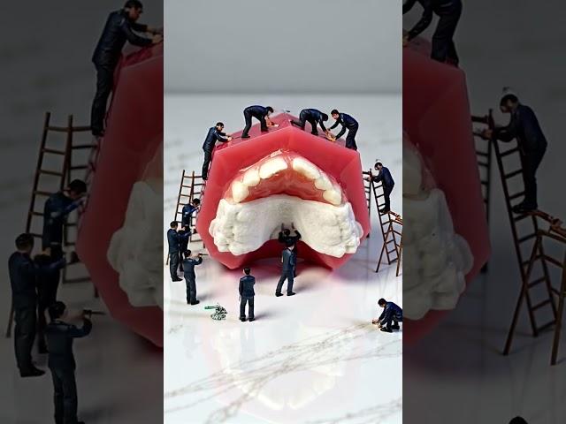 Invisalign Palatal Expander from ALIGN TECHNOLOGY  by DentalMovies