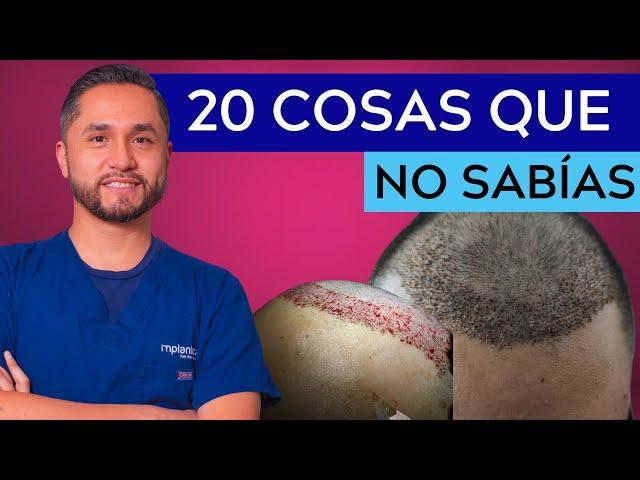 INJERTO de CABELLO en MÉXICO | 20 Cosas que no SABÍAS