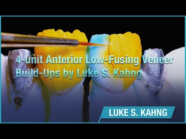 4-unit Low-Fusing Veneer Build-Ups by Luke S. Kahng