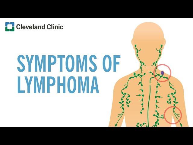 Warning Signs of Lymphoma