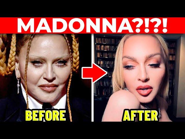 Plastic Surgeon: MADONNA's Cosmetic Surgery Transformation!