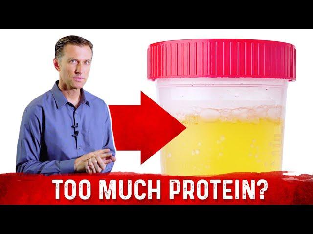 Top 5 Symptoms Of Eating Too Much Protein – Dr.Berg