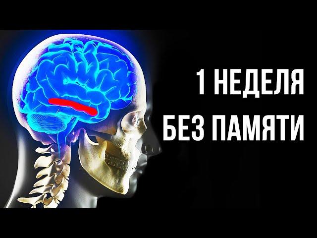 Что, если все 8 млрд человек вдруг потеряют память