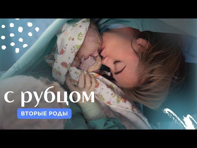 Роды с рубцом. Двое суток. Реальная история.