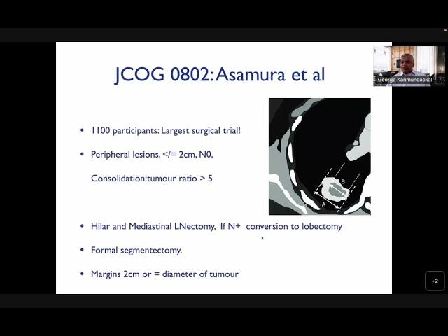 NBE- SURGICAL MANAGEMENT OF NSCLC & PANCOAST TUMORS- DR. GEORGE KARIMUNDACKAL