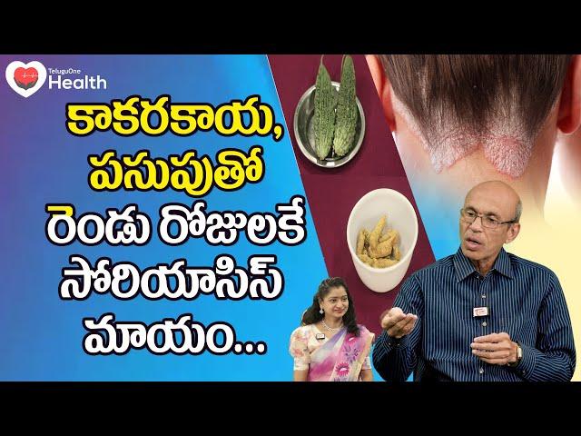 Psoriasis Cure | కాకరకాయ, పసుపుతో సోరియాసిస్ మాయం.. Dr. Ch Madhusudana Sarma | TeluguOne Health