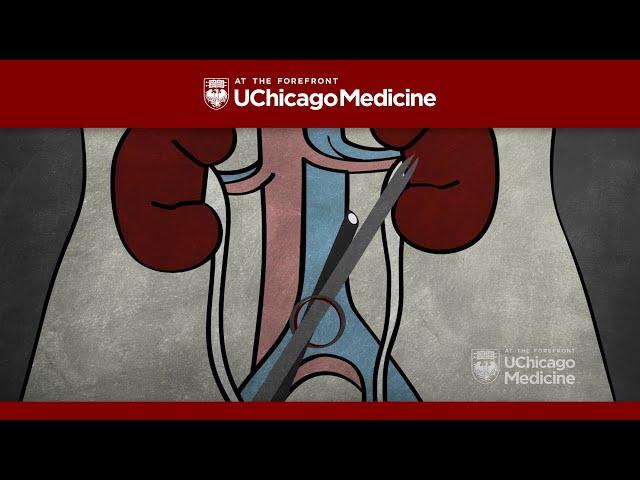 How does a laparoscopic (scarless) donor nephrectomy work?