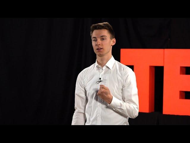 Make Positivity Your Superpower | Dennis Kiener | TEDxSSE