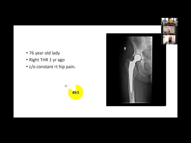 Periprosthetic joint infection -  viva practice for the FRCS Trauma and Orthopaedics exam