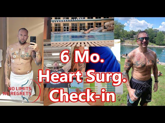 ROUGH 6 Months CARDIAC OP Surgery RECOVERY Home - OPEN HEART Surgery Story Time