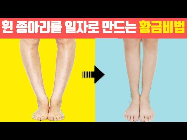 휘어진 종아리알 11자 만드는 황금비법 / 오다리교정,휜다리교정,비골두교정,휘어진다리