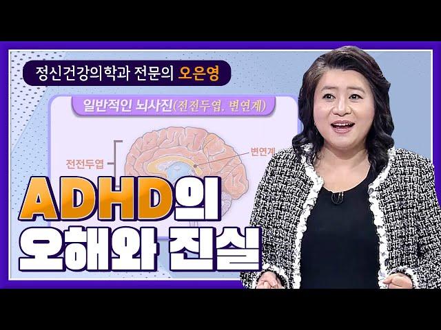 주의력결핍 과잉행동장애 ADHD, 오은영 박사가 오해를 풀어드립니다.┃60분 부모┃알고e즘