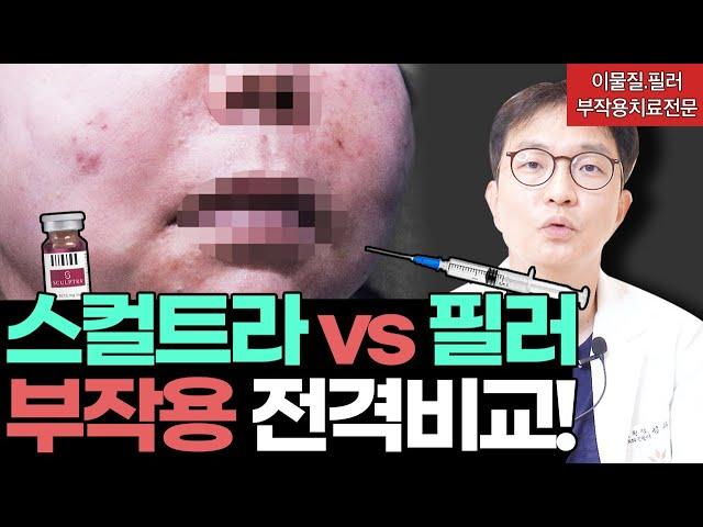 스컬트라 필러보다 안전하긴 합니다! 단 #스컬트라부작용 치료는 필러부작용보다 쉬울까요?  #필러부작용 #이물질부작용