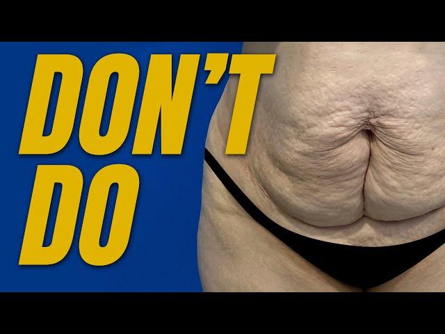 11 Things You Should NOT Do After a Tummy Tuck