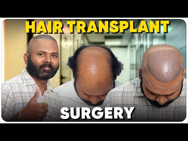 Hair Transplant in Bhopal | Best Results & Cost of Hair Transplant in Bhopal