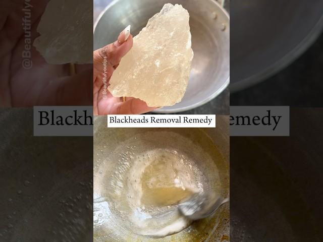 1 Day Blackheads/Whiteheads Removal, Glass Shine Nose #blackheads #skincare #beauty