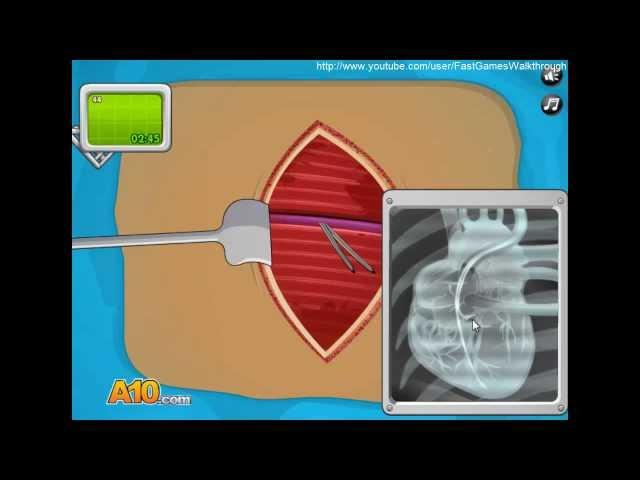 Operate Now: Pacemaker Surgery Fast Walkthrough