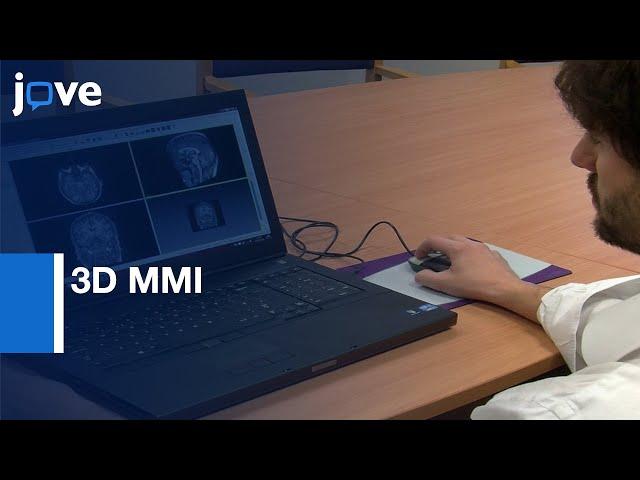 3D MMI and Computer Assisted Planning in Epilepsy Surgery | Protocol Preview