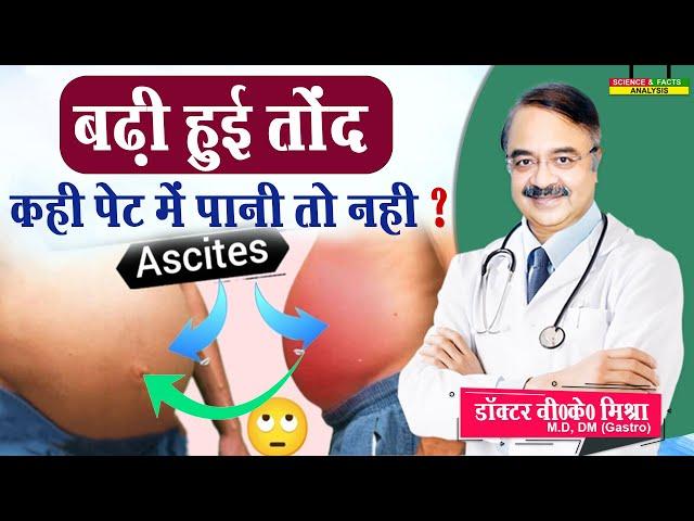 बढ़ी हुई तोंद कहीं पेट में पानी तो नहीं || ASCITIS SYMPTOMS