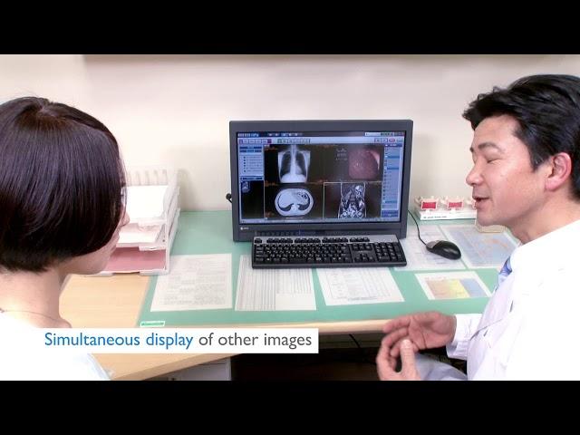 Konica Minolta ImagePilot Aero | Portable, High-Quality Imaging | Konica Minolta Healthcare