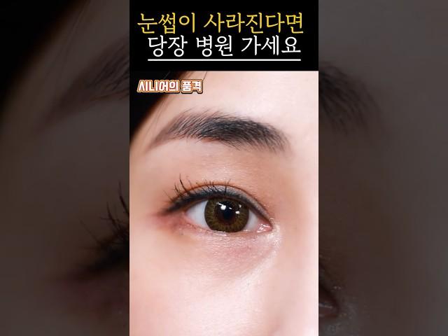 눈썹 끝이 사라진다면 병원 가세요｜갑상선 질환 초기 신호