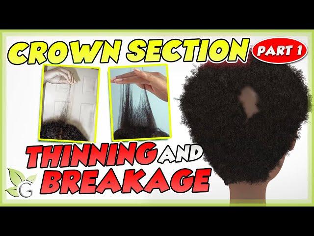 Crown SORENESS and BREAKAGE - Causes and Solutions (Part 1)