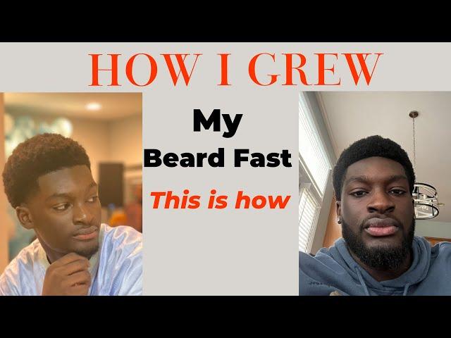 Grow a Full Beard in 6 Months with Minoxidil & Derma Roller | Step-by-Step Guide