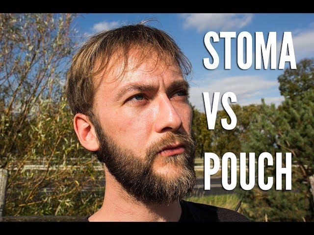 Stoma vs Pouch | Meine Vor - und Nachteile | Meine Erfahrungen