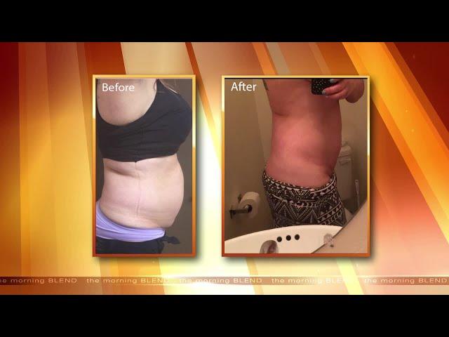 Non-Surgical Body Contouring That Will Help You Lose Weight In Las Vegas