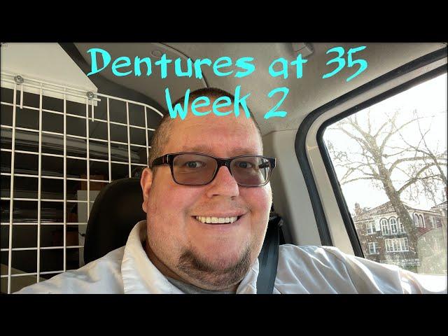 Week 2 with immediate dentures after 24 teeth extracted. Dentures at 35